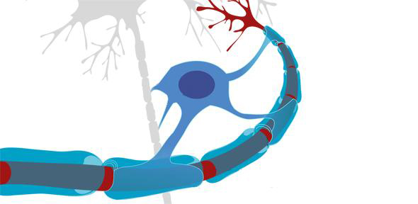Myelin Nervenschäden bei Multipler Sklerose